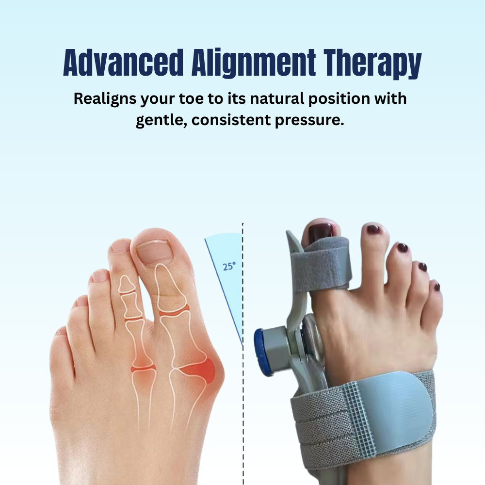 Medihelp You Bunion Corrector